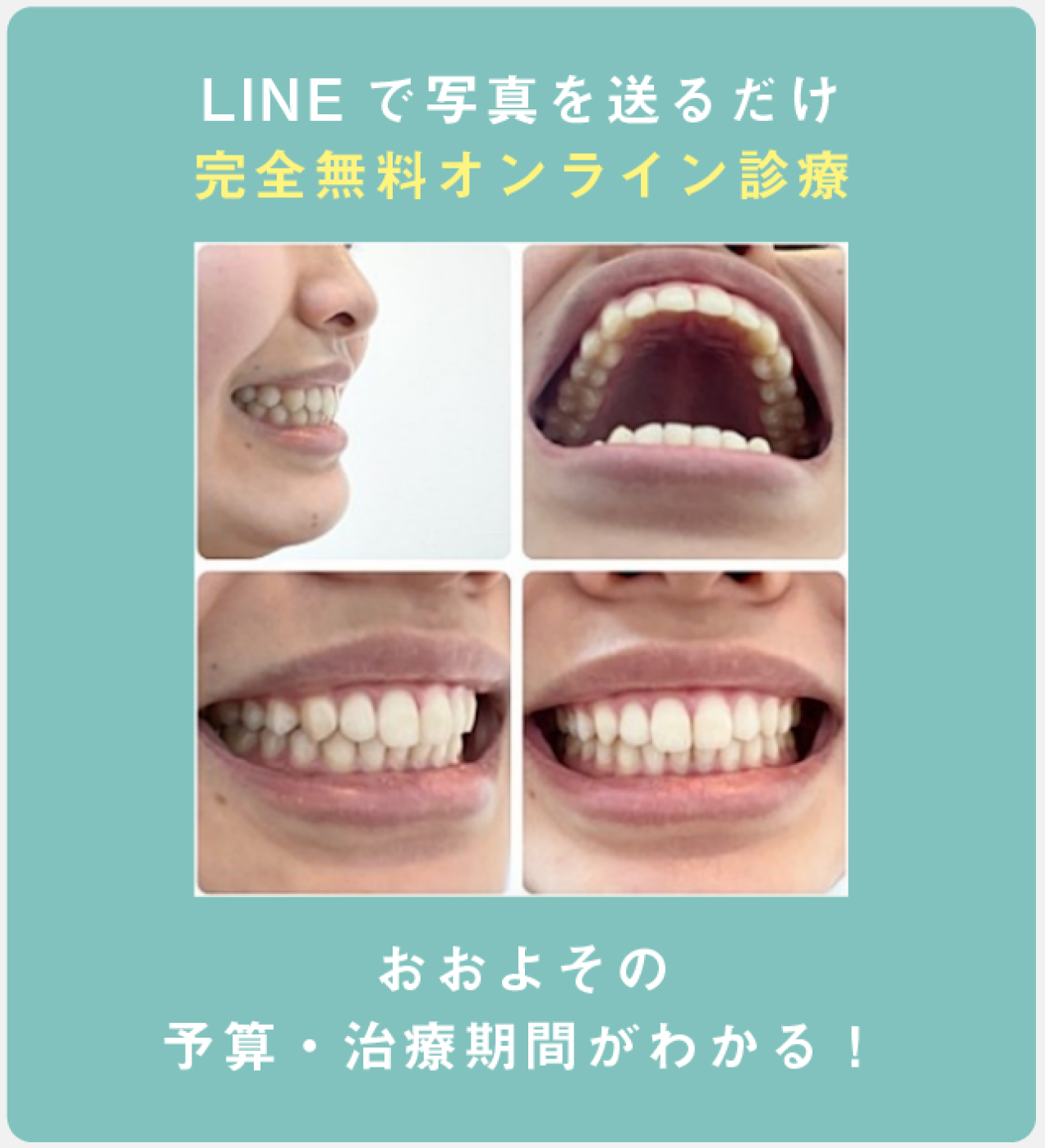 LINEで写真を送るだけ完全無料オンライン診断 おおよその予算・治療期間がわかる！